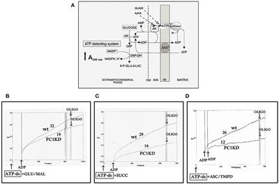 Activation of the Calcium-Sensing Receptor Corrects the Impaired Mitochondrial Energy Status Observed in Renal Polycystin-1 Knockdown Cells Modeling Autosomal Dominant Polycystic Kidney Disease